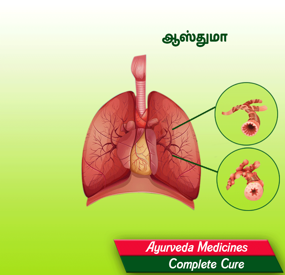 Diawin Siddha Asthma Treatment
